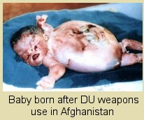 DU affected baby